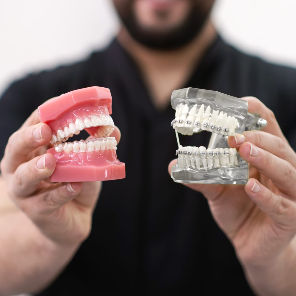 A dentist holds up an example of a mouth with Invisalign clear aligners in, and a set of teeth with traditional braces.