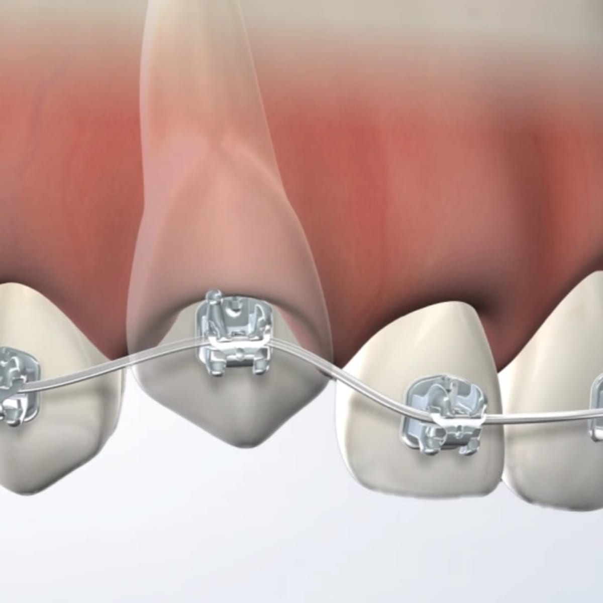 Team members at Nalchajian Orthodontics smile while they work on their computers.