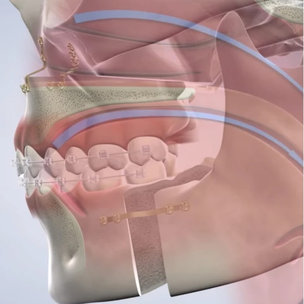 A team member at Nalchajian Orthodontics smiles at the camera.