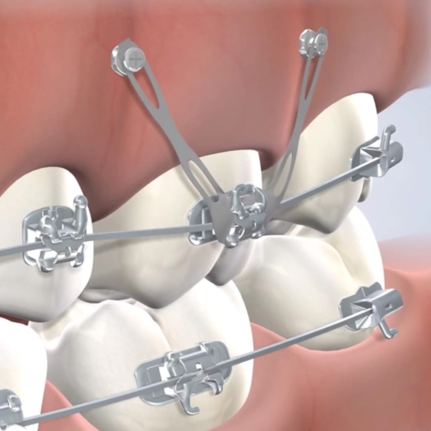 A team member at Nalchajian Orthodontics is smiling while working on her computer.