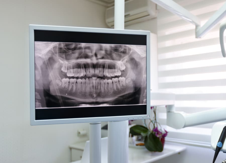 A dentist points to a panoramic X-ray.